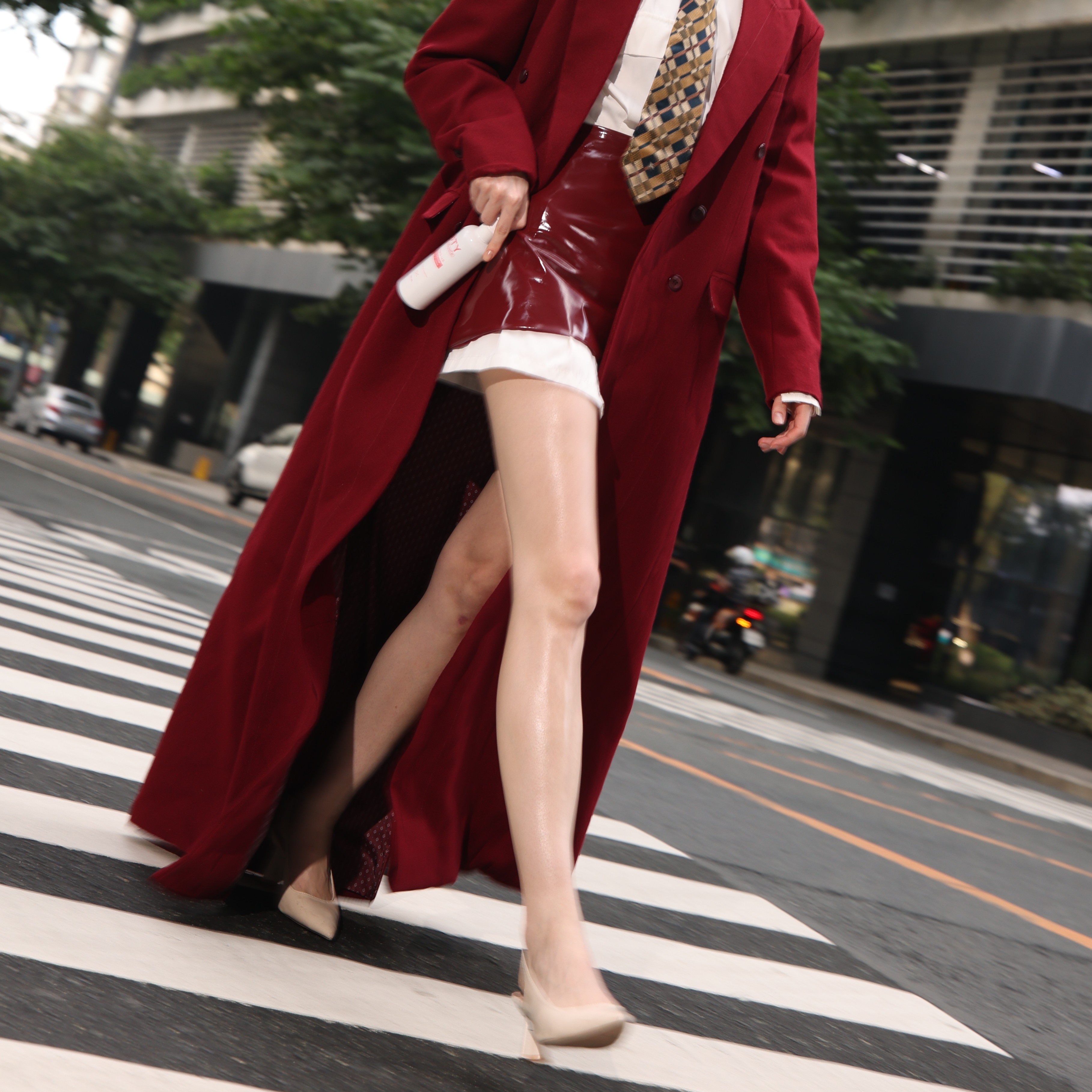Varicose veins article hero image